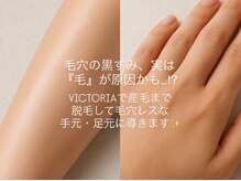 エムズスタイル ネイルバー(M's Style NAIL BAR)/産毛まで脱毛