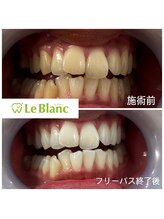 ルブラン 奈良店(Le Blanc)/特別な1日を最高の笑顔で