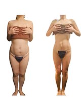 エモーション 町田店(E-Motion)/町田４０代からの本格痩身サロン