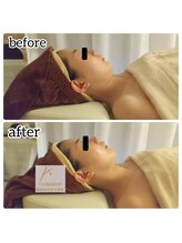 筋線美術コルギ 目黒店/20代～60代予約が殺到中★