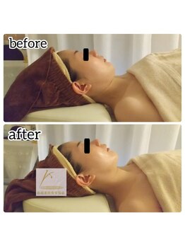 筋線美術コルギ 目黒店/20代~60代予約が殺到中★