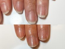 キラネイル アンド アイラッシュ by World Beauty(KIRA)/自爪育成