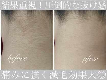 アリスビューティー(AliceBeauty)の写真