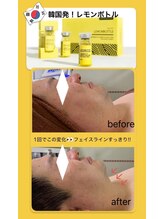 【美ネージュでレモンボトルでの効果を実感♪】