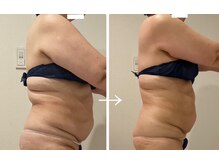 ピュウリリアーナ(Piu liliana)の雰囲気（50代のお客様☆※岡山に1台の結果にこだわった最強マシン使用!!）