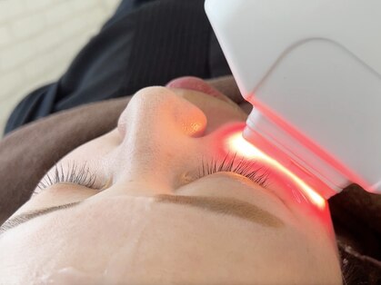 ヘルディン(heldin +555)の写真