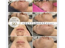 ビューティーブルーム(BeautyBloom)