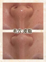 セーラマーレ(cera-mare Esthetic by CARDIA)/