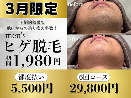 シェリエ(Sheller)の写真