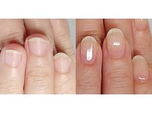カピリナ(Ka Pilina)の雰囲気（平たく広がった少しばかり反り爪だったお客様も3回目で感動！）