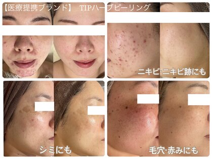 ニジュウニ クラレ(22curare)の写真