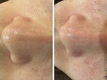 ケアナ 梅田店(CareNa)/メンズの清潔感ここにあり