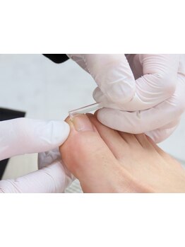 爪の悩みを解消できる（ケア含む）
