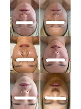 キュアリード(Cure_Lead)/本格小顔ケアはコルギで決まり！