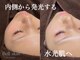 ベルスキン(Bell skin)の写真/お肌に優しいフルーツ酸×ハーブのハイブリッドピーリングでつるんと輝く水光肌へ。