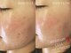 モエラビューティーサロン(Moela beauty salon)の写真