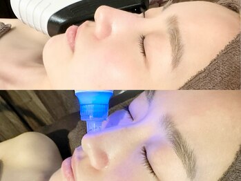 リリアック(Re:Lilyac)の写真/【四ツ谷三丁目徒歩3分】話題のフェイシャルエステで毛穴の黒ずみ・汚れをスッキリ洗浄!肌質改善で陶器肌へ
