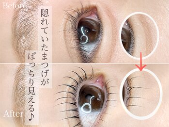 ベルベットアイズ 西宮北口(Velvet eyes)/上向きだった逆まつげを矯正