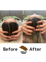 クマの冬眠 高知店/アタマのむくみスッキリ