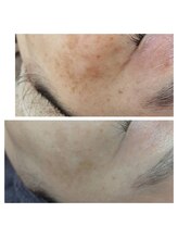 ビラ ベルダ(Bira Beldad)/