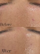 アイサロン ラソ(eye salon lazo)/【WAXXXX/ワックス脱毛】