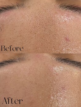 アイサロン ラソ(eye salon lazo)/【WAXXXX/ワックス脱毛】