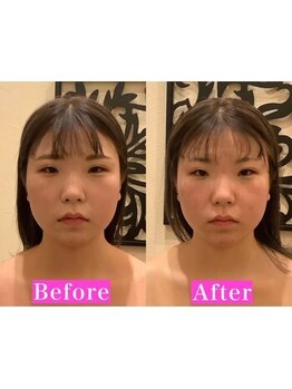 アジール 長岡リバーサイド千秋店(agir)/Before/After画像