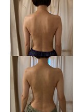 ニューミー スパ(newme spa)/肩のラインと背中スッキリ！