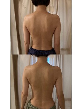 ニューミー スパ(newme spa)/肩のラインと背中スッキリ！