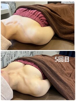 ロココ 豊田店(Rococo)/ビフォーアフター