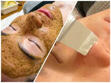 男性には男性が、女性には女性が担当、ヘッドスパは男性が施術。