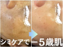 パールホワイトニングサロン 茅ヶ崎店の雰囲気（ハーブピーリング（はくりあり/なし）で透明感ある輝く素肌へ）