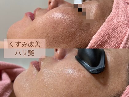 エシャーム(echarme)の写真