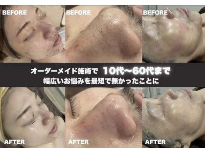 レア(le'a)の写真