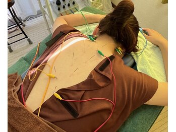 フォレスト治療室の写真/首・肩のつらさに鍼灸&整体の組み合わせ。国家資格者の施術でスッキリ!