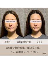 エレーニ 麻布十番(ELENI)/1ヶ月一回のメンテナンス