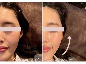 ハーシークレット(Her secret)/小顔マシーン＜小顔＞