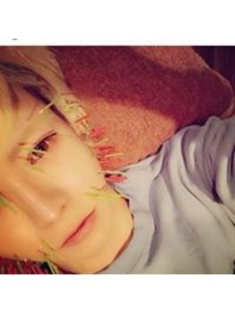 ルディア 堀江店(ledia)/ユーチューバーよきき様(美容鍼)