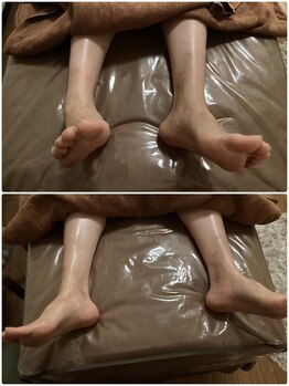 カレン/軟部組織のリリース