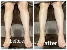 ヴェント(VENTO)/リフレクソロジー☆