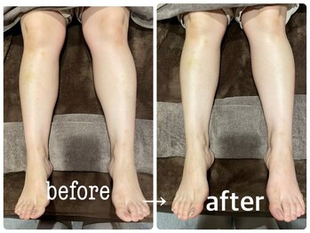 ヴェント(VENTO)/リフレクソロジー☆