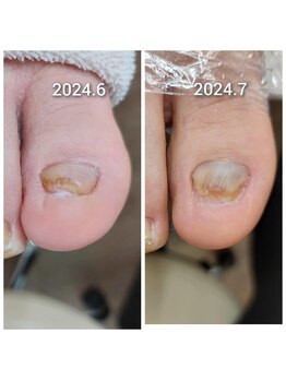 爪切り屋 足楽/諦めず～その２