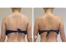 ハクカスパ(HAKUKA SPA)/