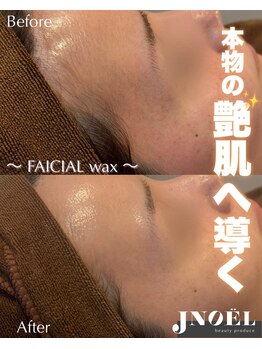 ジェノール 2nd beauty studio 姫路駅前店(JNOEL)/本当の艶肌へ導く！