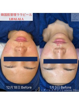 ロワゾーブリュ 代官山店(L'oiseau Bleu)/ララピール