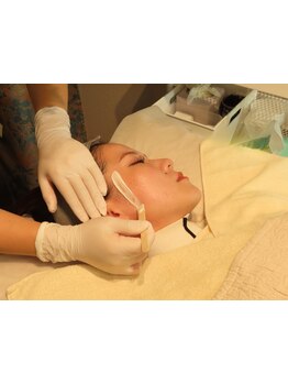 顔脱毛がしたい