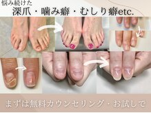 アーティネイルズ(Aaty Nails)/老若男女問わずok◎爪のお悩みに