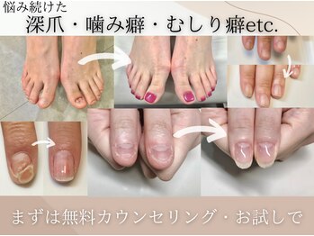老若男女問わずok◎爪のお悩みに