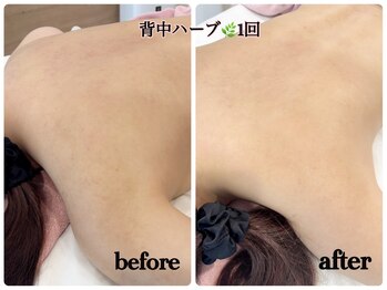 シルク(Cilk)/ハーブ背中