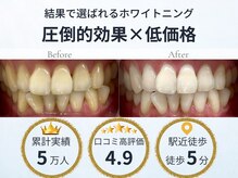 LBSホワイトニング 吉祥寺店